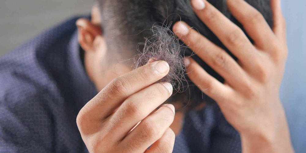 Solutions de perruques cheveux pour la perte de cheveux progressive : Choix et entretien